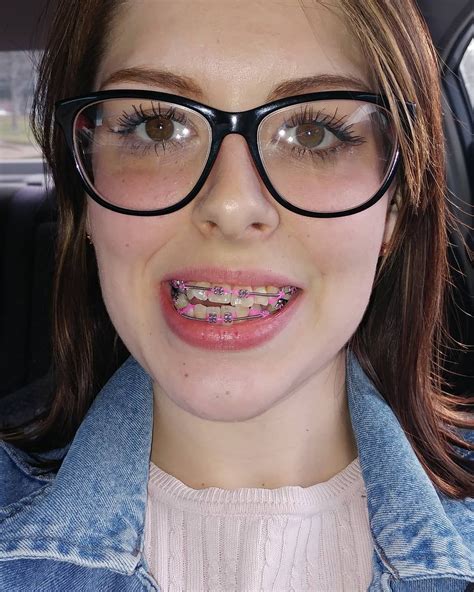 braces girl twitter